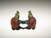 dental-prothetics2
